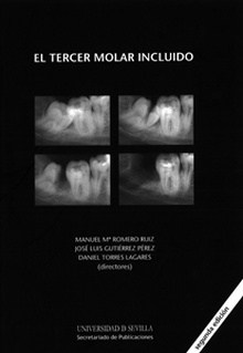 El tercer molar incluido