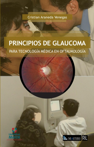 Principios de glaucoma para tecnología medica en oftalmología