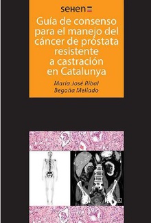 Guía de consenso para el manejo del cáncer de próstata resistente a castración en Catalunya