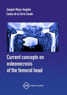 CURRENT CONCEPTS ON OSTEONECROSIS OF THE FEMORAL HEAD