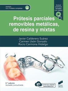 Prótesis parciales removibles metálicas, de resina y mixta (2ª edición revisada y actualizada)
