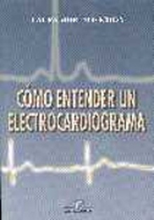 Cómo entender un electrocardiograma