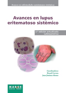Avances en lupus eritematoso sistémico - Latinoamérica
