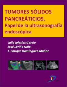 Tumores sólidos pancreáticos. Papel de la ultrasonografía endoscópica