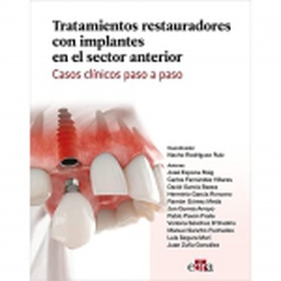 Tratamientos restauradores con implantes en el sector anterior. Casos clínicos paso a paso.