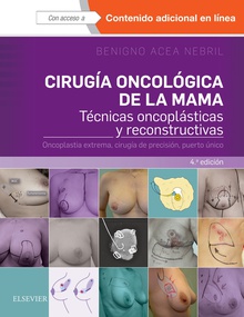Cirugía oncológica de la mama (4ª ed.)