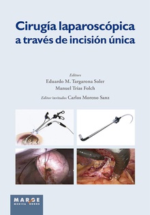 Cirugía laparoscópica a través de incisión única