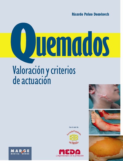 Quemados