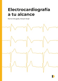 Electrocardiografía a tu alcance