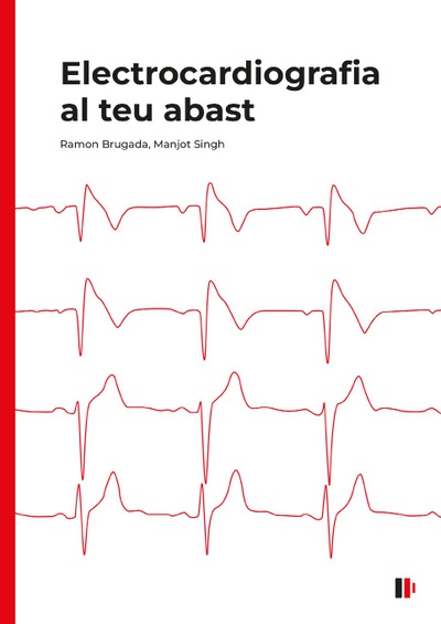 Electrocardiografia al teu abast