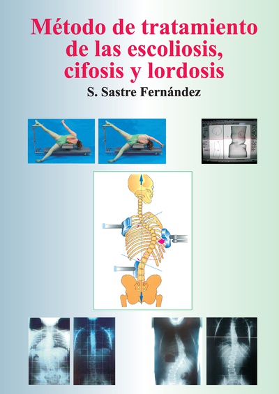 Método de tratamiento de las escoliosis, cifosis y lordosis