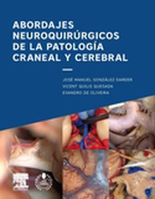 Abordajes neuroquirúrgicos de la patología craneal y cerebral