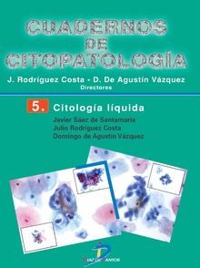 Citología líquida