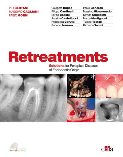 Retreatment. Solutions for apical diseases of endodontic origin