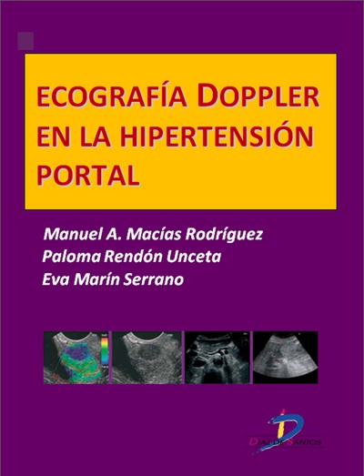 Ecografía Doppler en la hipertensión portal