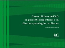 Casos clínicos de ECG en pacientes hipertensos en diversas patologías cardiacas