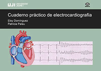 Cuaderno práctico de electrocardiografía.