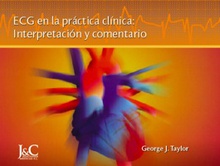 ECG en la práctica clínica: Interpretación y comentario