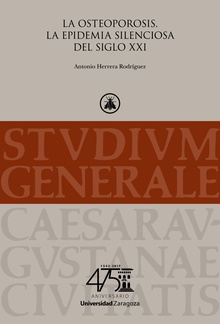 La osteoporosis. La epidemia silenciosa del siglo XXI