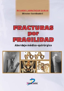 Fracturas por fragilidad