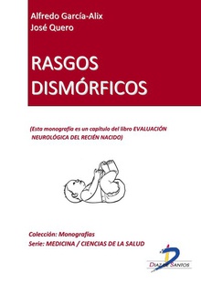 Rasgos dismórficos