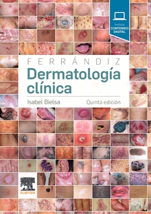 Ferrándiz. Dermatología clínica