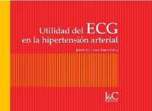 Utilidad del ECG en la hipertensión arterial