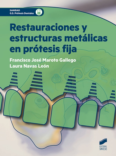 Restauraciones y estructuras metálicas en prótesis fija