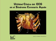 Utilidad Clínica del ECG en el Síndrome Coronario Agudo