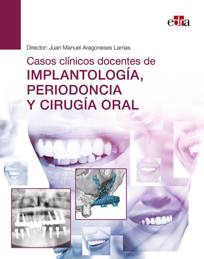 Casos clínicos docentes de implantología, periodoncia y cirugía oral