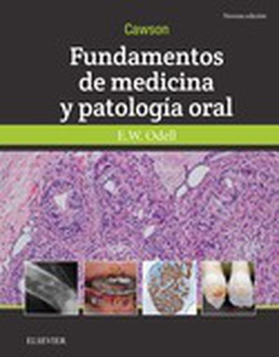 Cawson.Fundamentos de medicina y patología oral