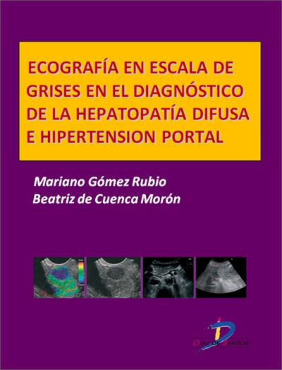 Ecografía en escala de grises en el diagnóstico dela hepatopatía difusa e hipertensión portal