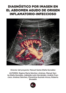 Diagnóstico por imagen en el abdomen agudo de origen inflamatorio-infeccioso